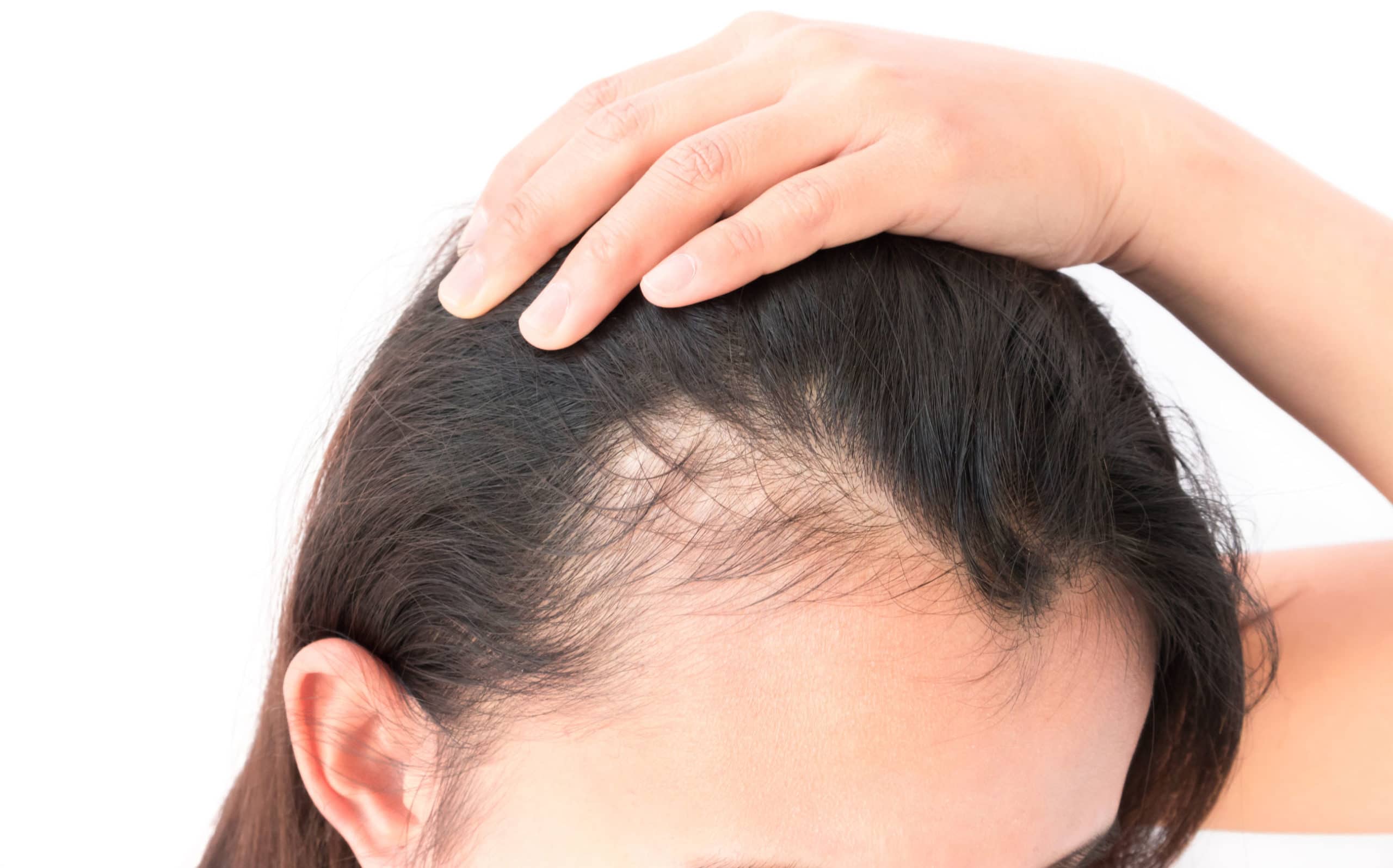 Hairlossireland have great hair loss products
